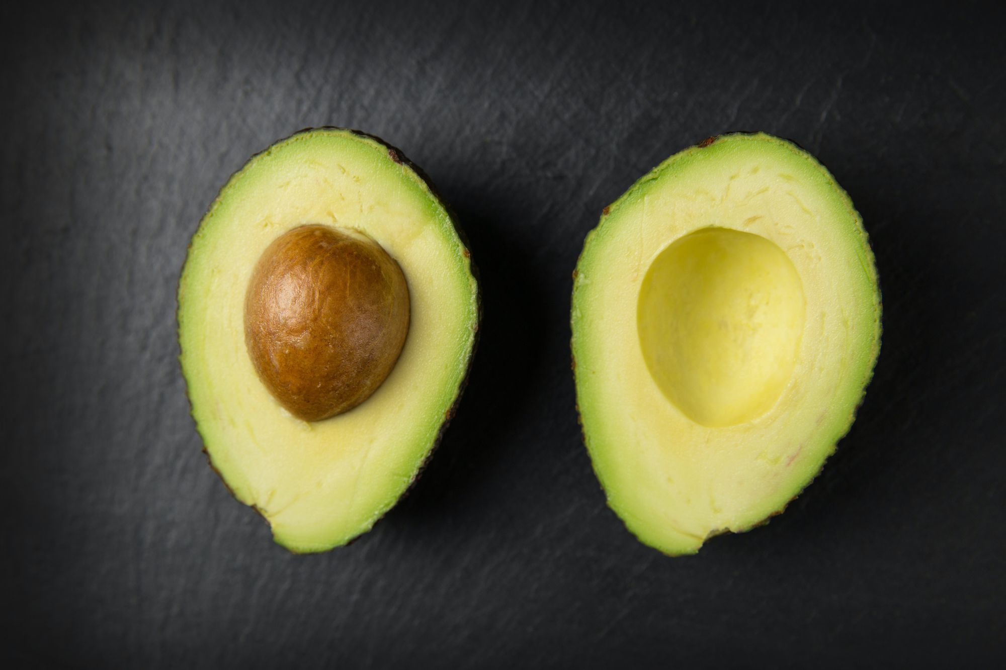 avocado rich in magnesium glycinate